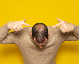 Thinning Hair & Baldness Support