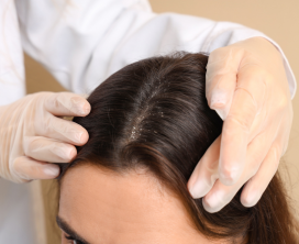 Fungal Scalp Infection Treatment