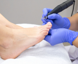 Athlete’s Foot Treatment