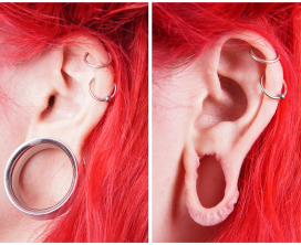 Torn Ear Lobe Repair