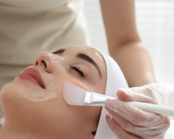 Chemical Peels for Acne