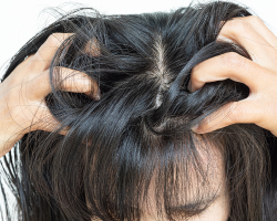 Itch & Irritation Relief Treatment