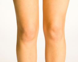 Leg & Thigh Lipoma Removal