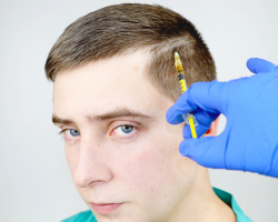 Mesotherapy for Hair Regrowth