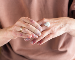 Topical Medication & Cream Therapy