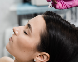 Mesotherapy for Hair Regeneration
