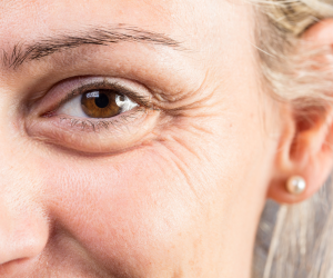 Eye Area Firming & Wrinkle Reduction