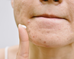 Topical Creams & Medicated Skincare