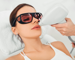 Upper Lip & Chin Hair Removal