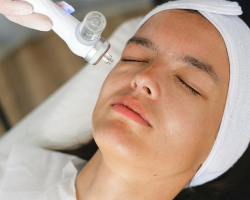 Face Laser Hair Removal