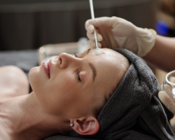 Chemical Peels & Skin Brightening