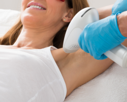 Underarm Laser Hair Reduction