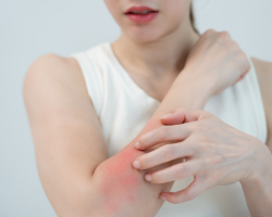  Skin Allergy & Infection Treatments