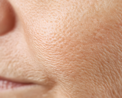 Skin Texture & Pore Refinement