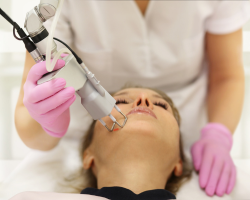 Laser Treatment for Melasma