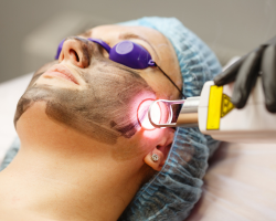 Laser Skin Rejuvenation
