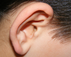 Ear Lobe Reconstruction