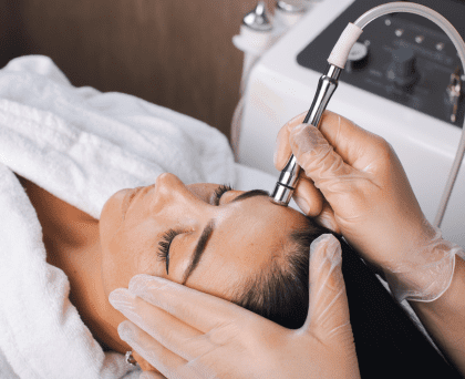 Carbon Laser Facial