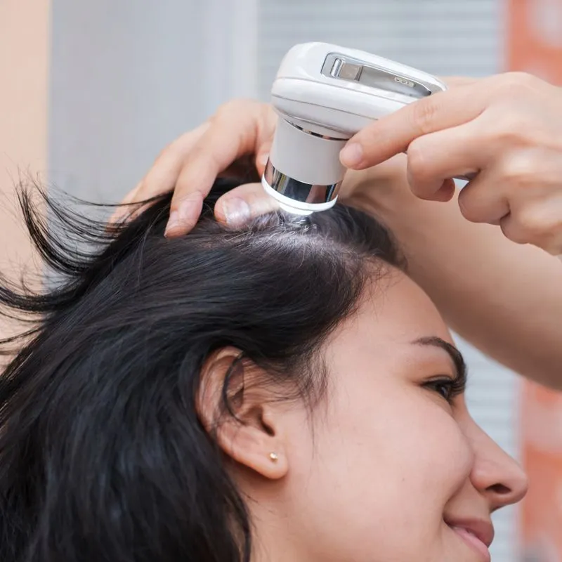 Best hair clinic in Chennai