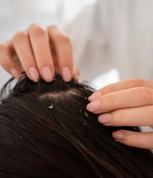 best hair loss treatment