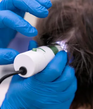 hair treatment for hair fall