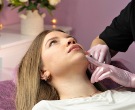 Carbon Laser Facial